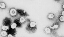 Kemenesi Gábor-A koronavírus járvány és ami még várható